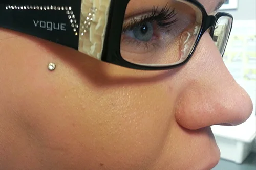 DERMAL_30.jpg