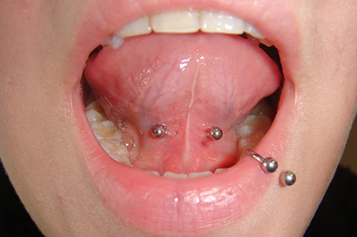 LIPPE_2.jpg