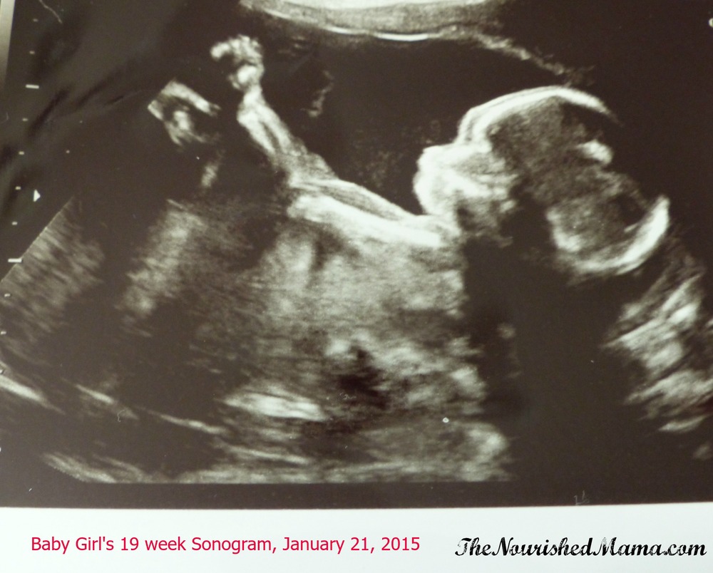 Baby Girl's 19 week Sonogram.jpg