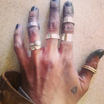 various sterling and 14k gold rings - and the usual state of my hands...