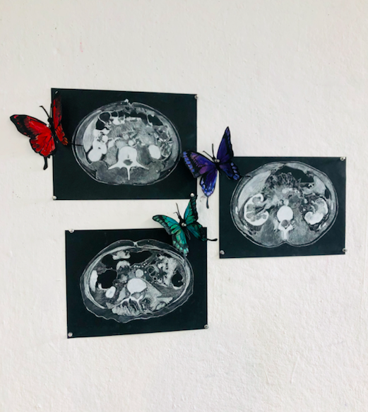  Butterflies in My Stomach: White Charcoal on black paper, Gouache on paper  