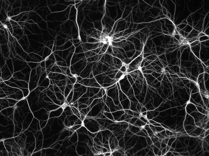 brain neurons compressed.jpg