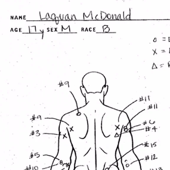 Autopsy of Laquan McDonald