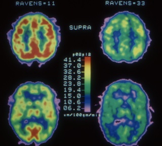 Podcast Notes] Richard Haier: IQ Tests, Human Intelligence, and Group  Differences