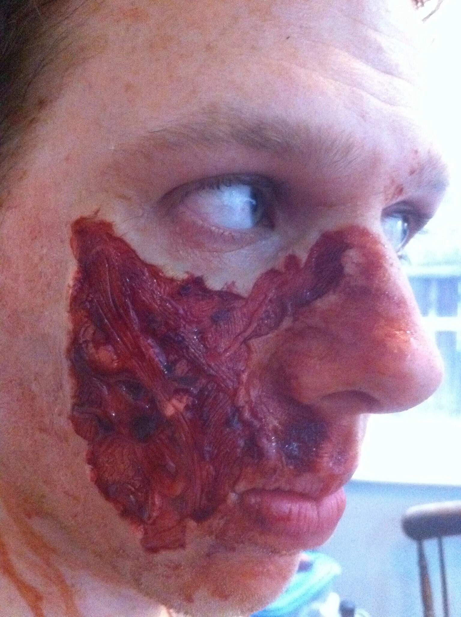 Flat silicone prosthetic