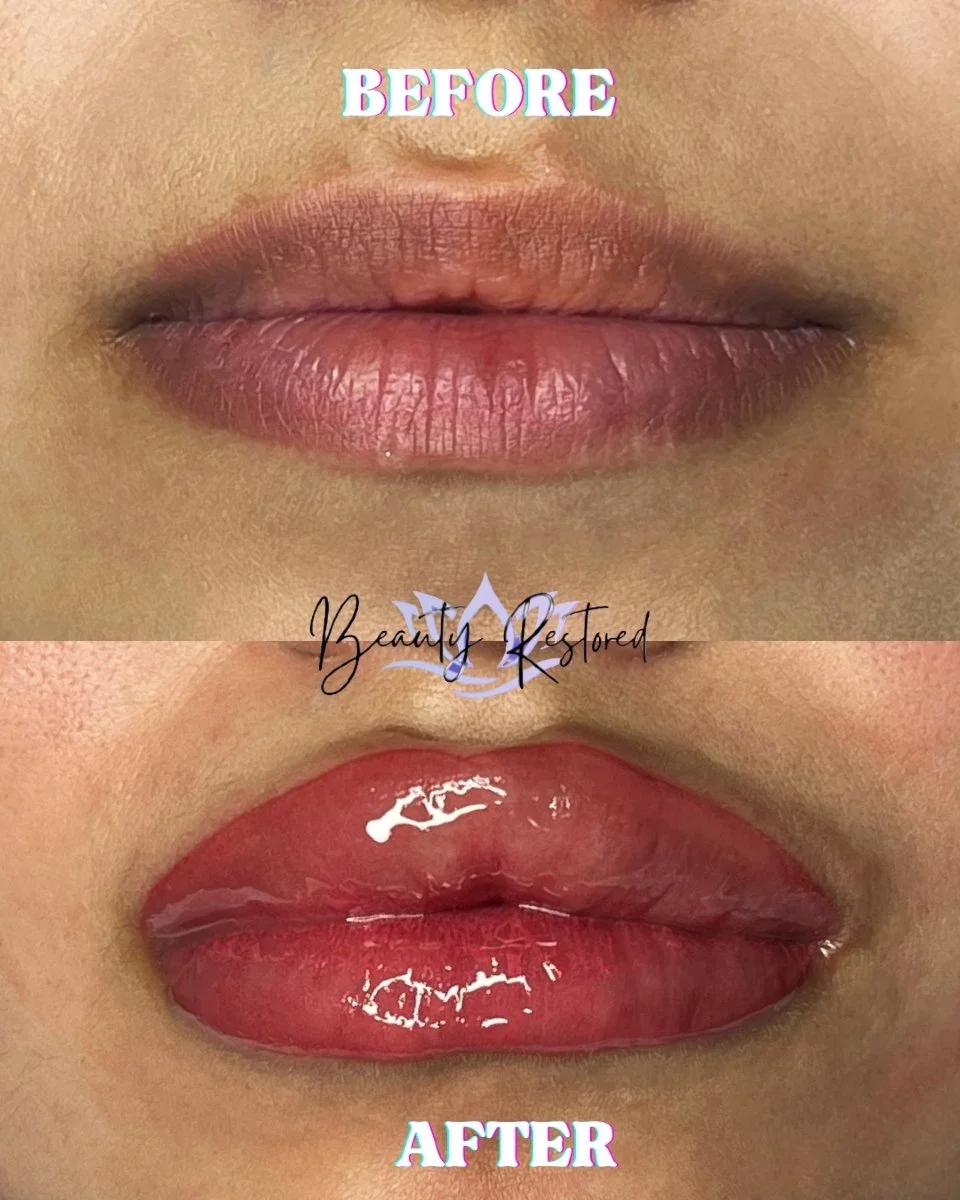 Just missing a little color and shape on the top lip&mdash;nothing a little lip blushing can&rsquo;t fix! 👄

✋ Keep in mind: color always looks more intense right after your appointment, and some swelling is totally normal (like you see here).
As it