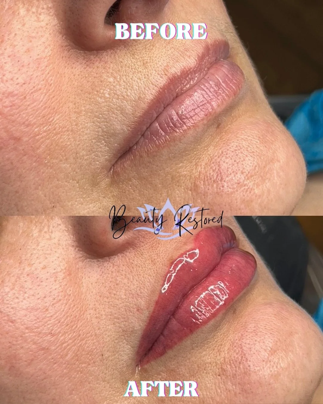 Get a Perfect Pout with Lip Blushing 💋
Enhance your lips with a soft, natural tint that lasts! Lip blushing is ideal for defining your lip shape, adding subtle color, and cutting down on your daily lipstick routine. Effortless, long-lasting, and bea