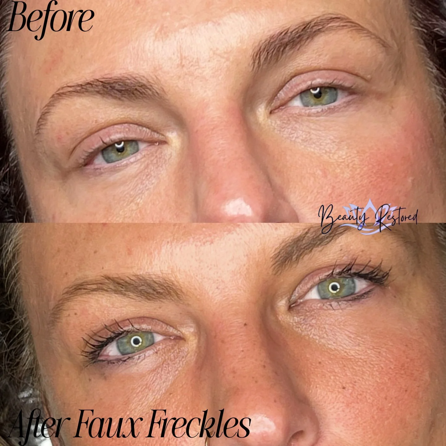 ✨ Say hello to Hailey&rsquo;s new glow! ✨

These faux freckles were created to give her that sun-kissed, natural look without the sun damage. 🌞 Freckle tattoos are a form of permanent makeup that gently implants pigment to mimic the look of real fre