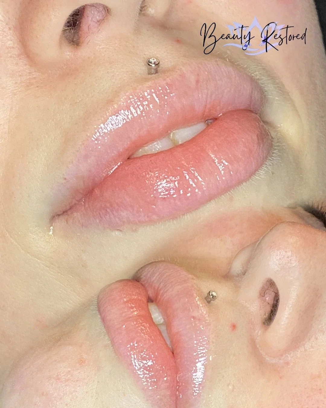 If this popped up on your feed&hellip; take it as your official sign to get a Lip Blush 😌💄✨

This treatment is perfect for enhancing your natural lips and boosting your confidence. It can help with:

&bull; Faded or uneven lip color
&bull; Lips tha