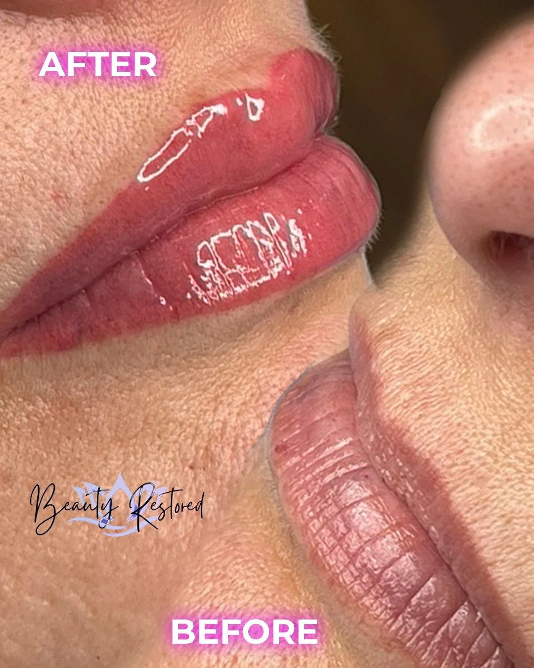 Bringing dull lips back to life, one lip blush session at a time! 💋✨
How gorgeous is this transformation?

Here&rsquo;s what you should know about lip blushing:

👄 It&rsquo;s a form of cosmetic tattooing that enhances your natural lip color and sha