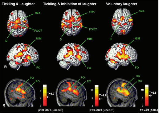Red/orange/yellow = brain regions activated 