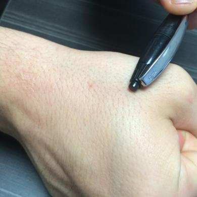 Insertable devices are tiny and invisible to the naked eye, whereas GPS technology remains large and bulky.
