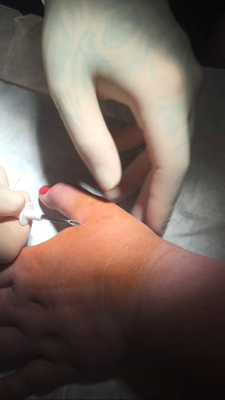 Consenting adults receive microchips with zero tracking & monitoring capabilities.