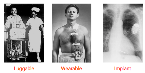 Evolution of the Pacemaker 