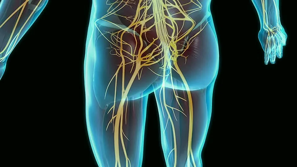 Healthy Q & A: Supplements for Sciatic Pain