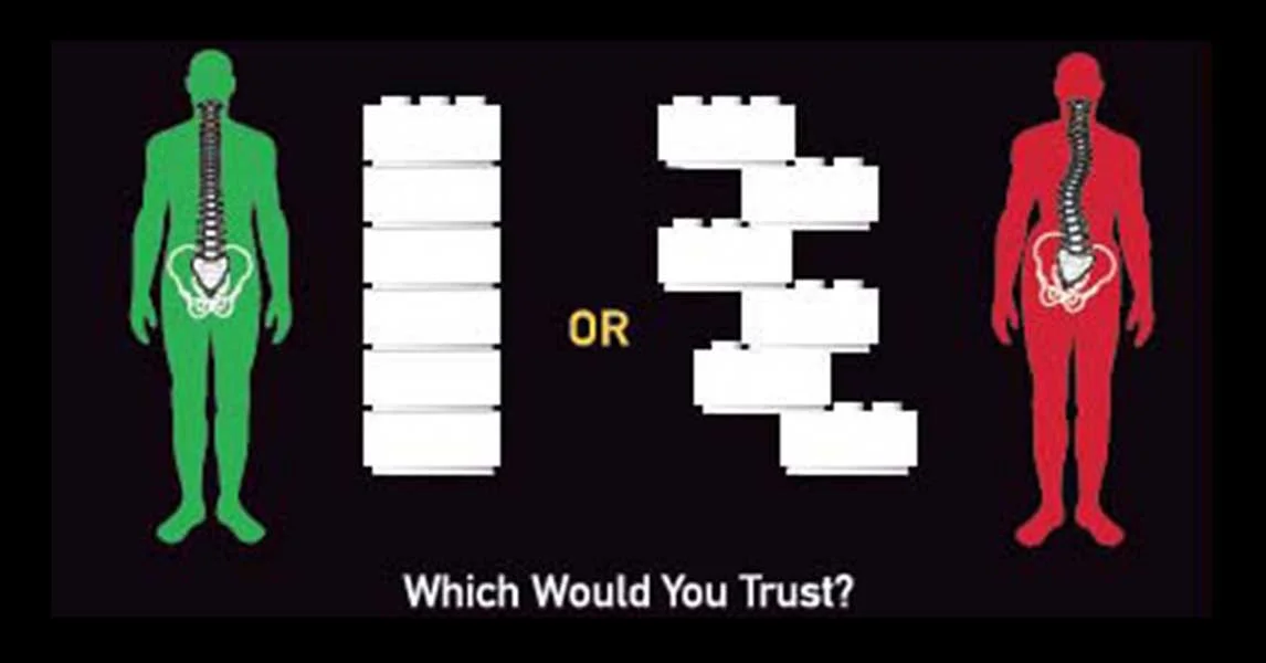 What is a Structural Shift and do I have one?