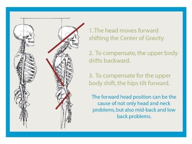 Texting 📱puts 22 kg of extra pressure on a persons spine&hellip;

As the head moves forward to compensate the upper body moves backwards, to compensate for the upper body the hips tilt forwards. 
As a result this forward head 🗣position (called Ante