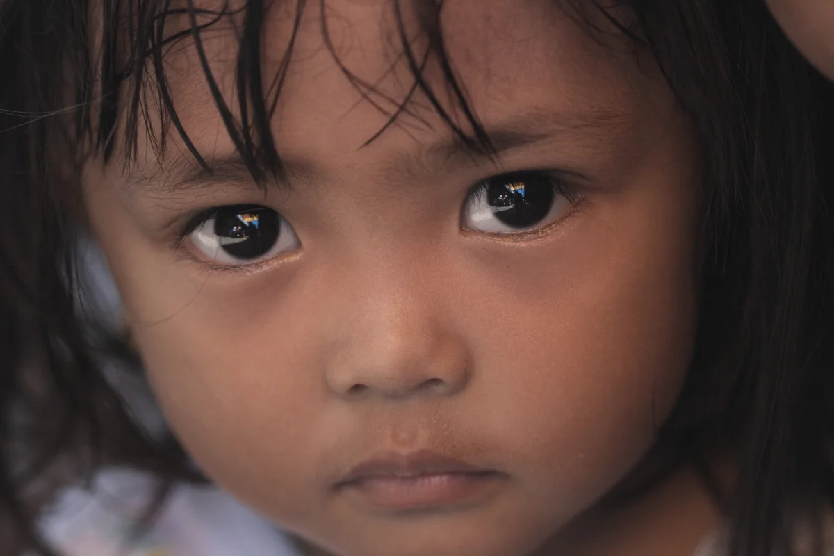  SMILE TRAIN MISSION IN TARAKAN, INDONESIA (2009) 
