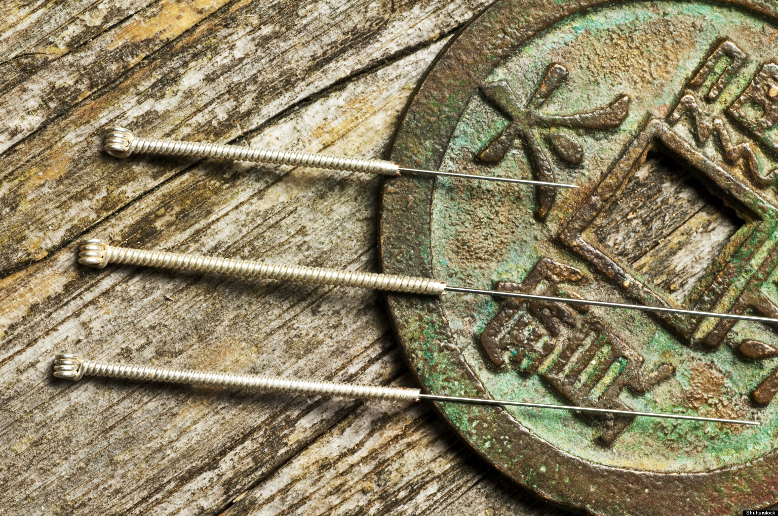ACUPUNCTURE-STRESS.jpg