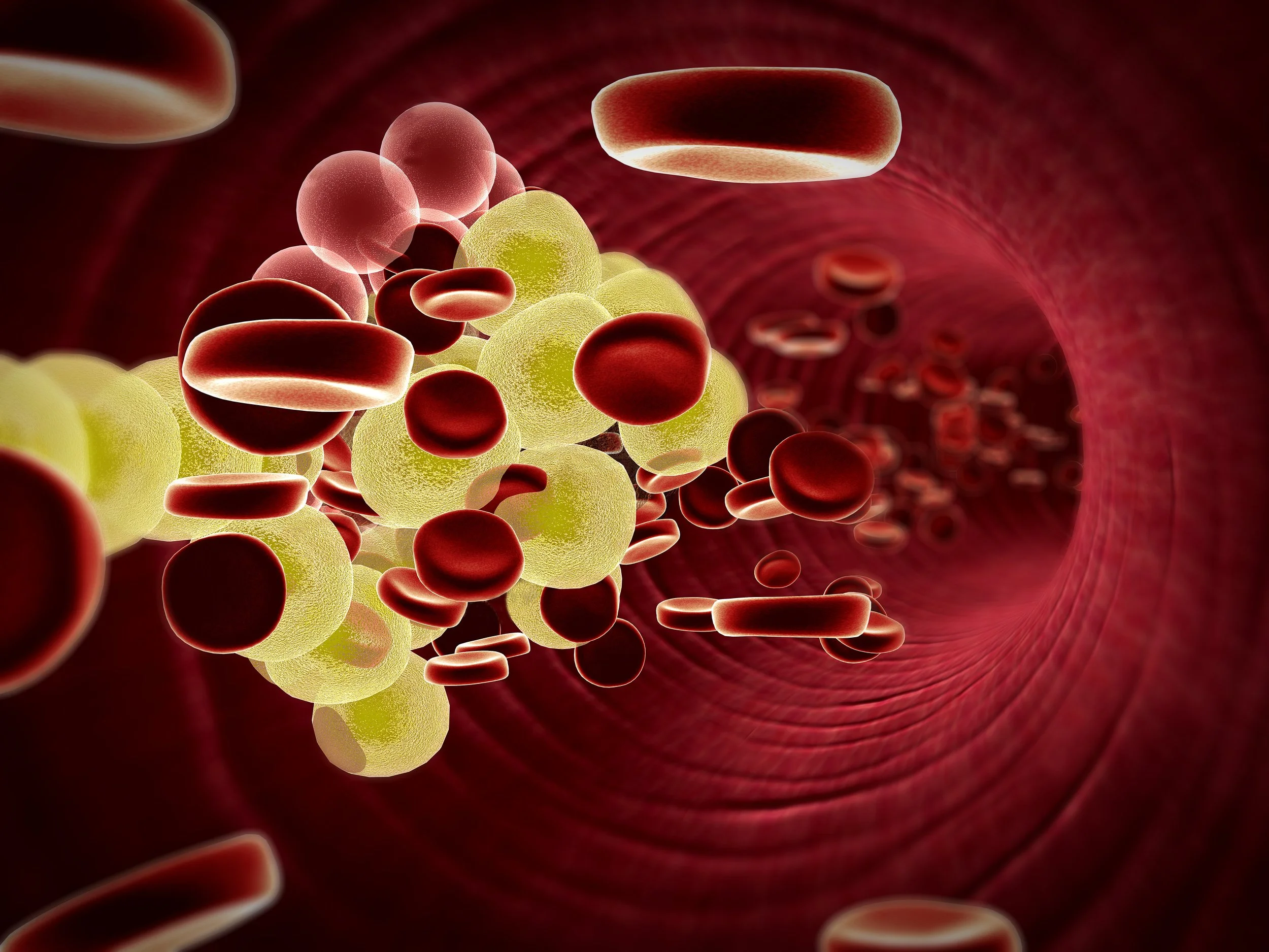 What to do about high cholesterol