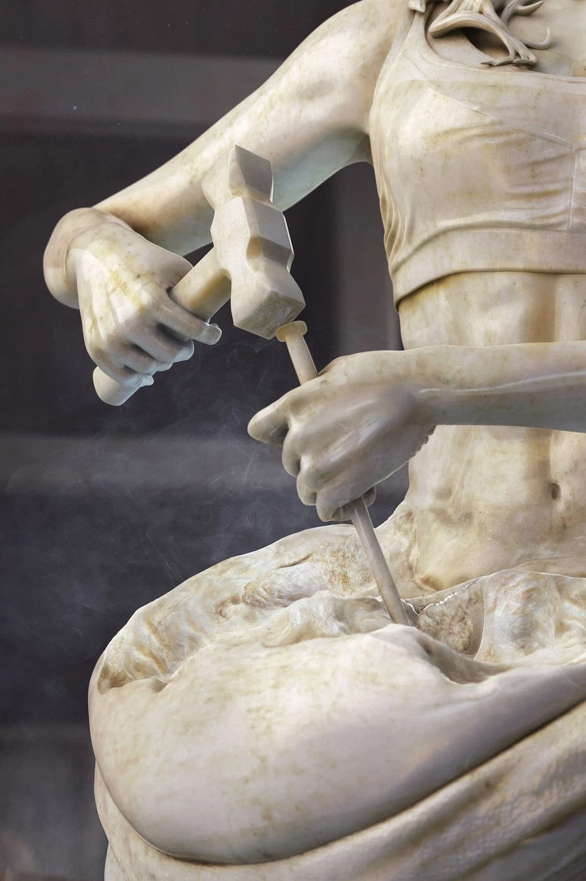 ¿Cuánto cuesta una liposucción en México?