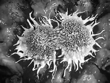 cancer cells.jpeg