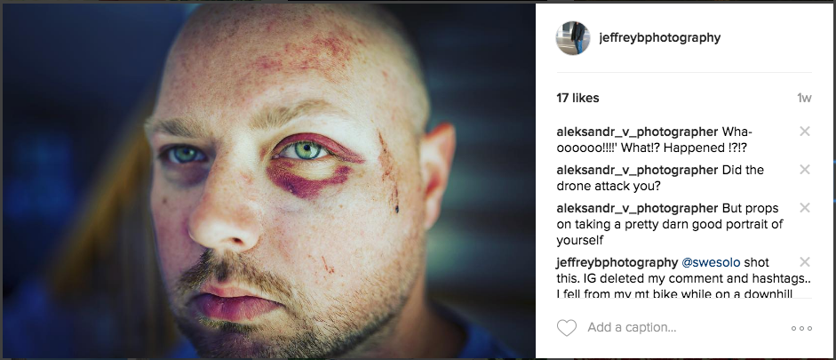 This photo does not convey the severity of the injury. 