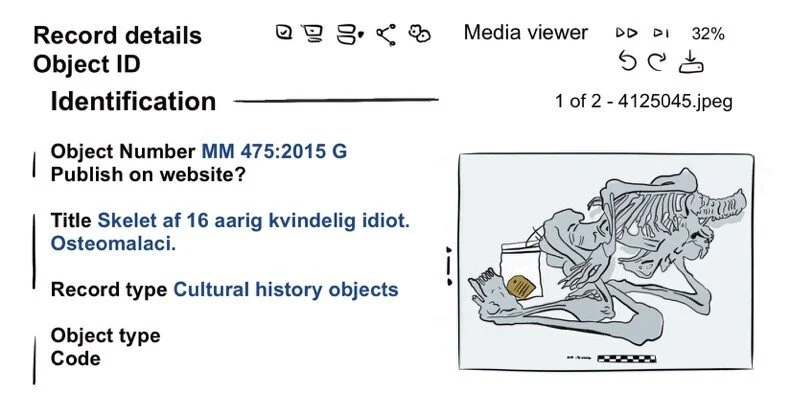 A drawing reproducing a digital record from an internal database of a medical museum. The title reads (translated from Danish): Skeletong of a 16 year old woman idiot, osteomalaci. Next to it, a grey skeleton with no head, in a foetal position.