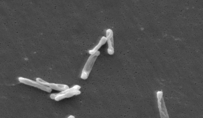 Scanning electron micgrograph of individual C. difficile bacilli cultured from a stool sample of an infected individual.