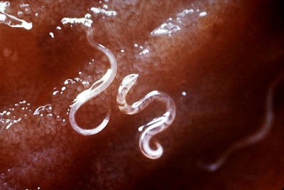 Hookworms attached to intestine.