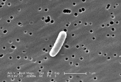 Scanning electron micrograph of E. Coli bacterium.