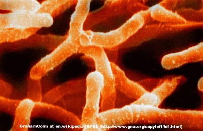 Electron micrograph of a type of Actinomyces , the genus of the natural host of TM7, discussed in the paper.