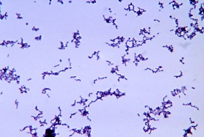 Optical microscope image of Propionibacterium acnes, the bacteria that causes acne.