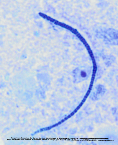 Example of a segmented filamentous bacteria.