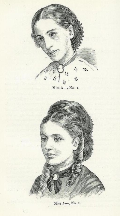 Sketches of Miss A before (top) and after (bottom) treatment for anorexia nervosa by William Withey Gull. Dr. Gull was among the first people to be clinically establish and treat anorexia, and was responsible for naming the disease.