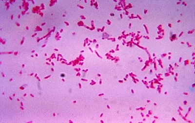 Optical microscope image of bacteria from the genus Fusobacteria .
