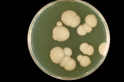 Candida albicans growing in petri dish