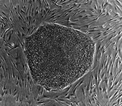 Human embryonic stem cell colony
