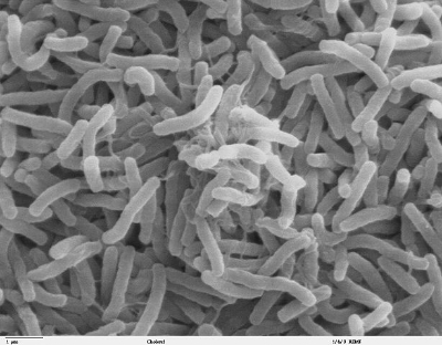 Scanning electron microscope image of&nbsp;Vibrio cholerae, the cause of cholera and a major cause of diarrhea-associated deaths each year.