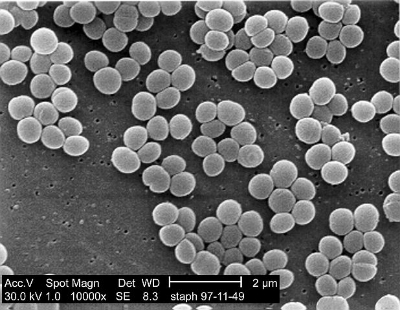 Electron micrography of Staphylococcus aureus .