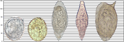 Different helminth eggs