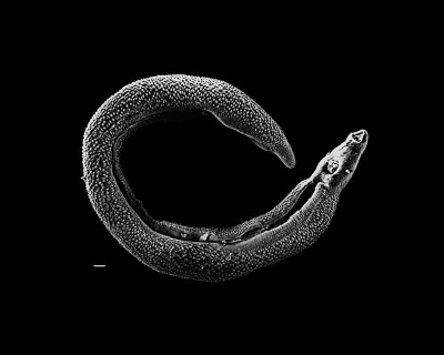 Schistosoma parasite worm, otherwise known as a blood fluke.