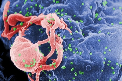Scanning electron micrograph of HIV-1, colored green, on a lymphocyte.