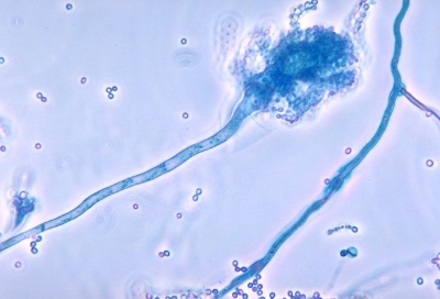 Common example of fungi hyphae