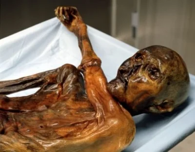 Oetzi the Iceman