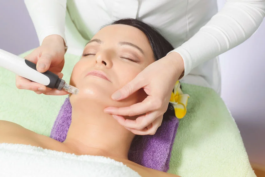 microneedling.jpg