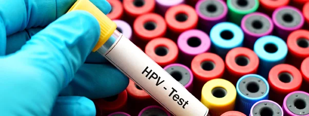 HPV_tubes.jpg