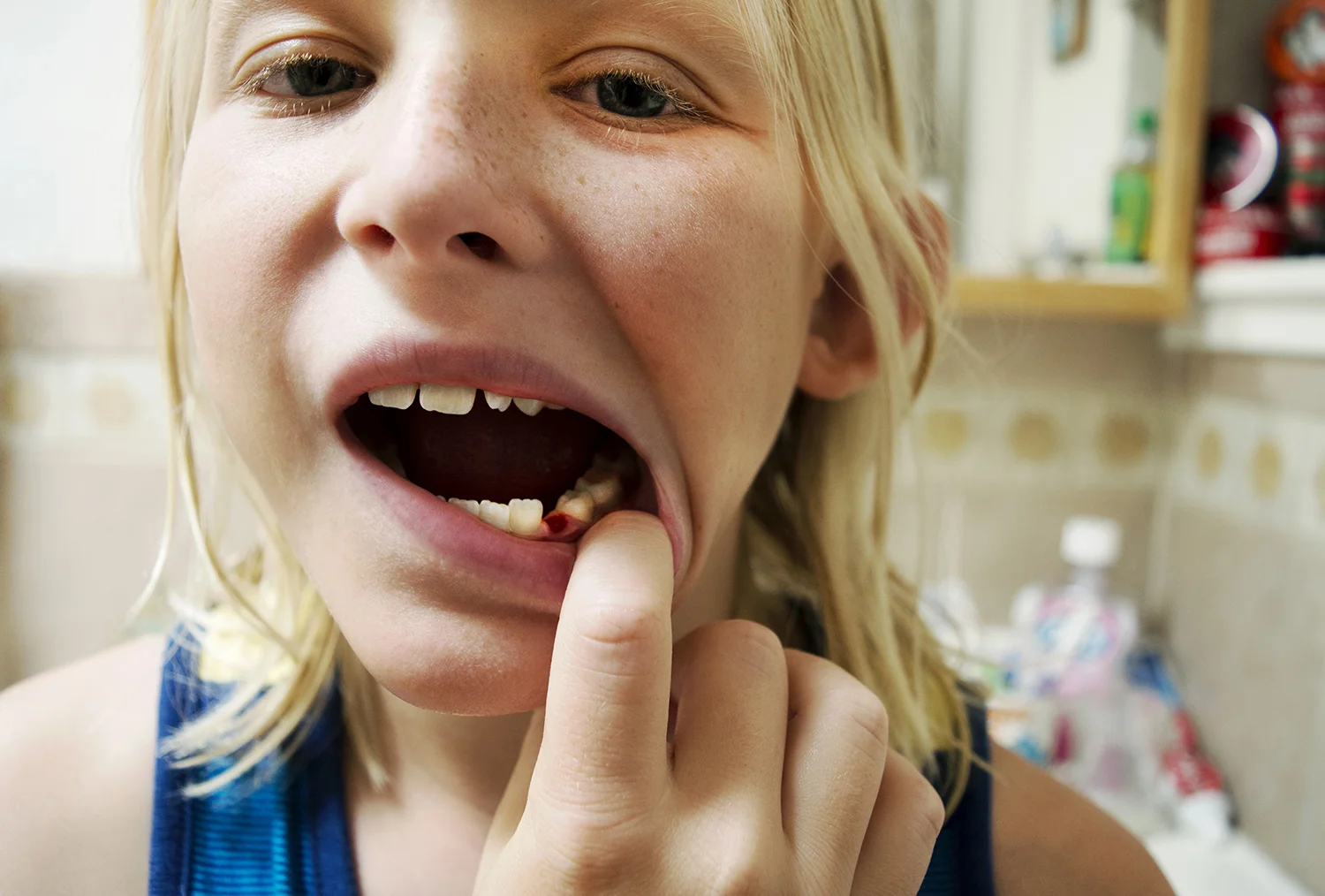 Almost Out Of Baby Teeth
