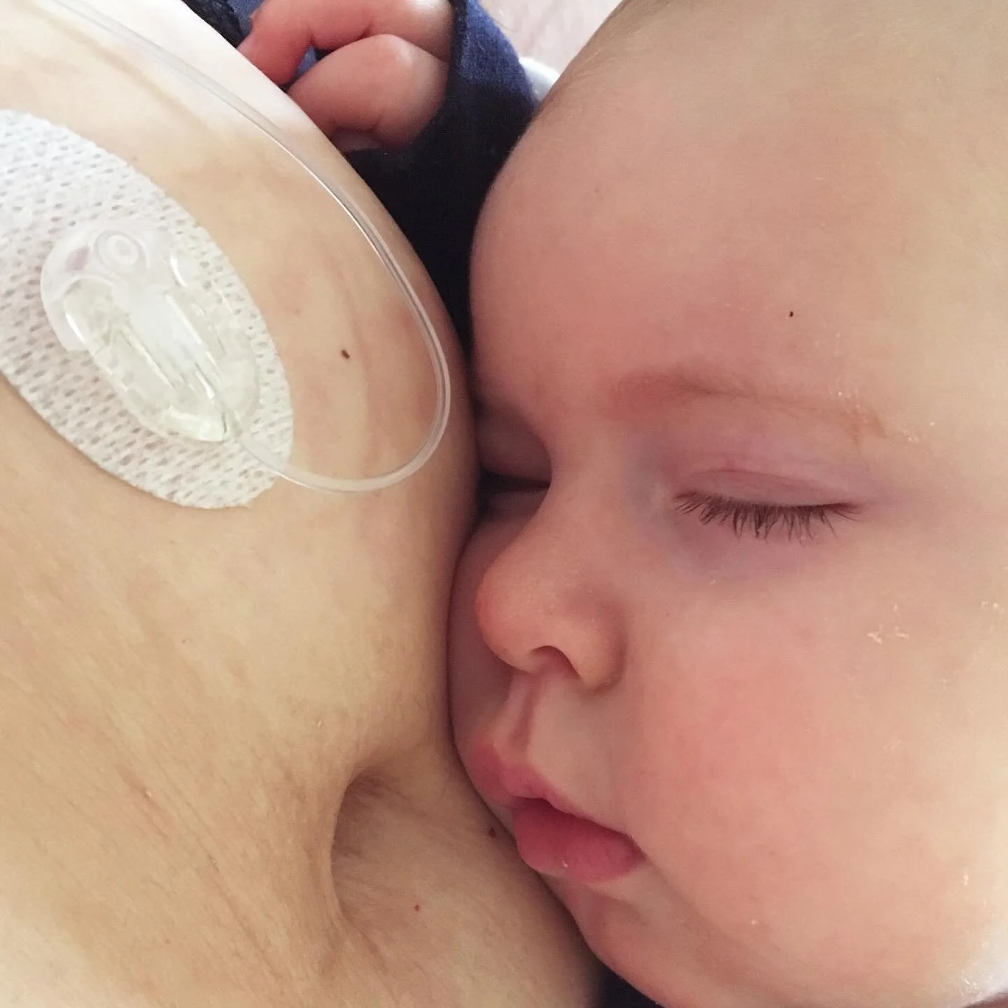 Toddlers, tiny hands, tubes and tangles&hellip;

I often hear from new and expectant mums either already using a pump, or starting pump therapy and worried about little hands and wriggly bodies pulling out cannulas and getting tangled in tubing.
As a