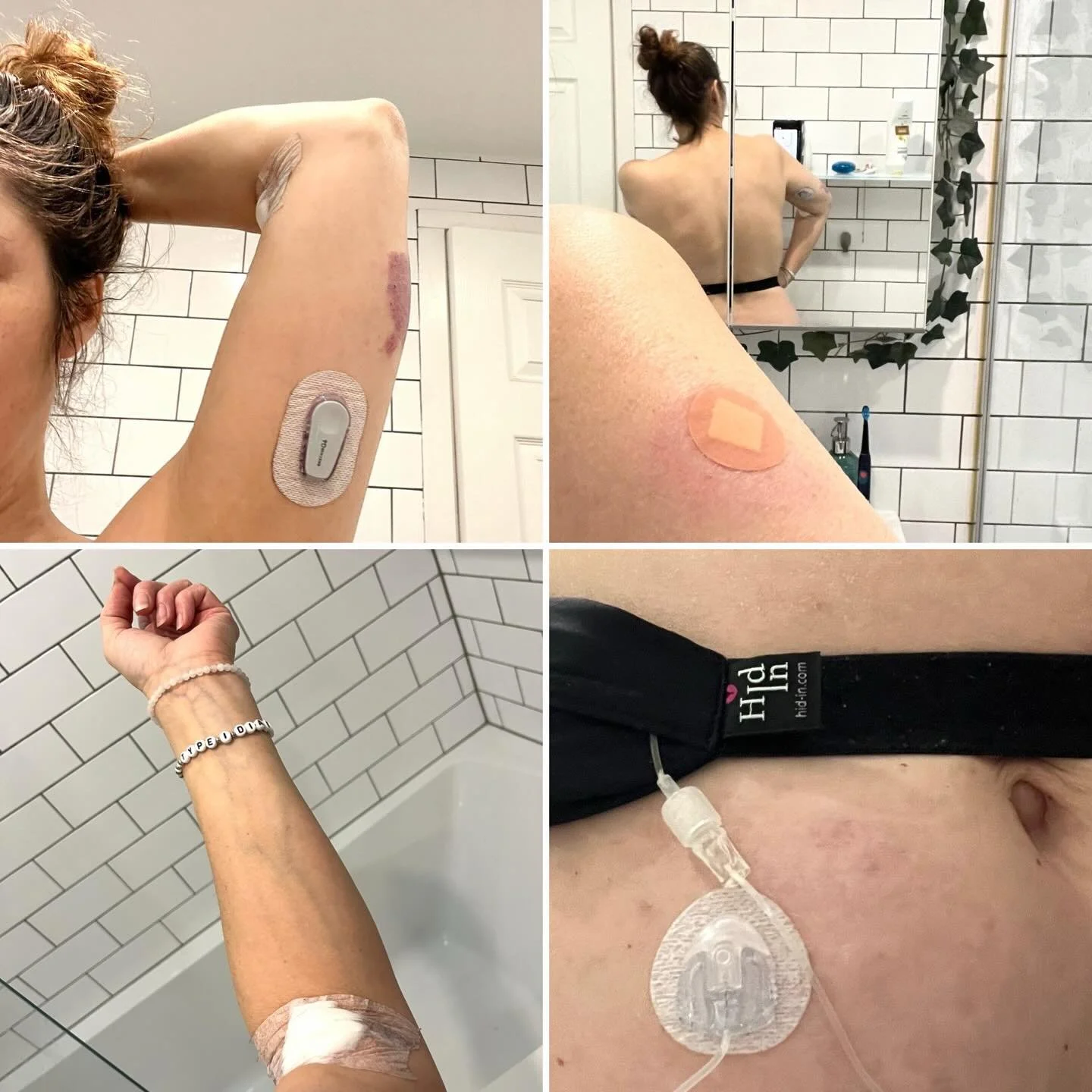 The Type 1 to do list ✅ 

Yesterday, in addition to my &lsquo;Work&rsquo; to do list, and my &lsquo;Family&rsquo; to do list, I ticked a lot of things off my T1 to do&rsquo;s. 
I had a doctor&rsquo;s appointment to go through my diabetes checks, then